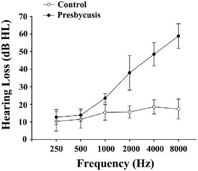 Presbycusis Disrupts Spontaneous Activity Revealed by Resting-State Functional MRI